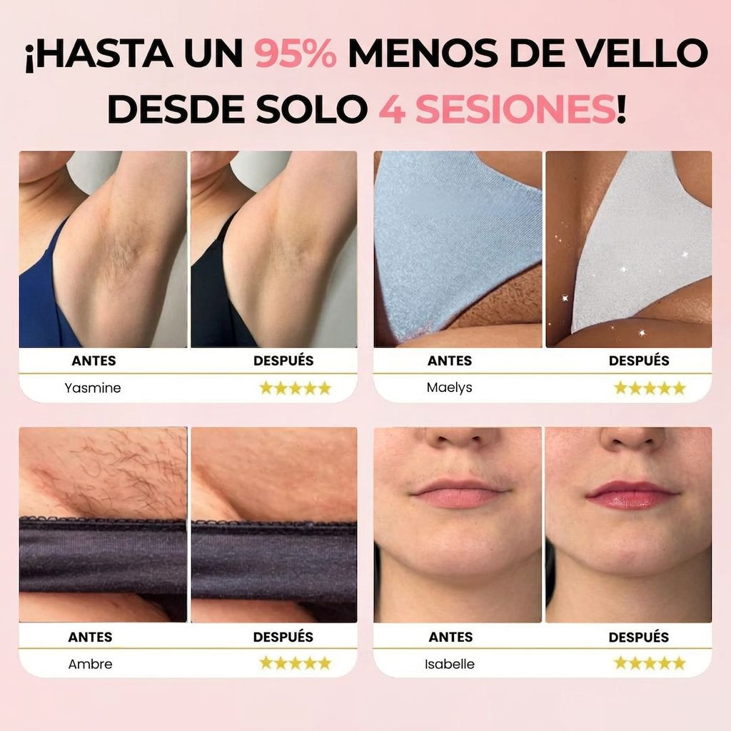 IPL Pulse • Depiladora de Luz Pulsada